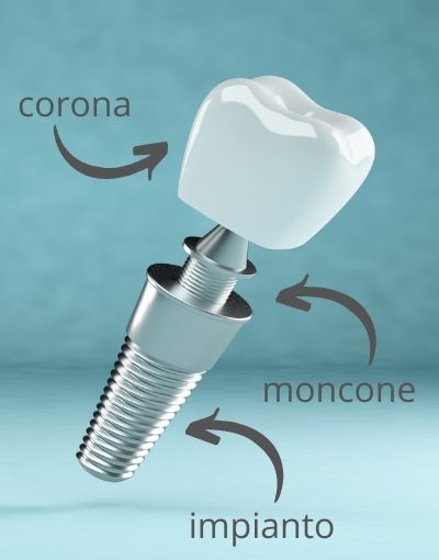rasaerba robotizzato
